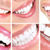 8 Ways to Get a Better Smile