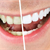 Get Healthier, Whiter Teeth -- the Safe Way